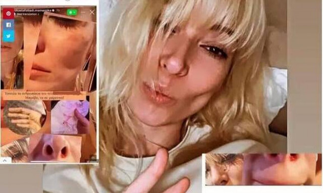 Μικαέλα Φωτιαδή: Ξυλοκόπησαν το μοντέλο - «Έστειλε τελικά τα ανθρωπάκια του… Μπράβο να σε χαίρονται»