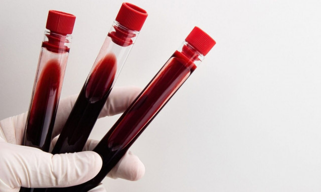 Οι εξετάσεις αίματος μπορούν να προβλέψουν πόσο θα ζήσετε
