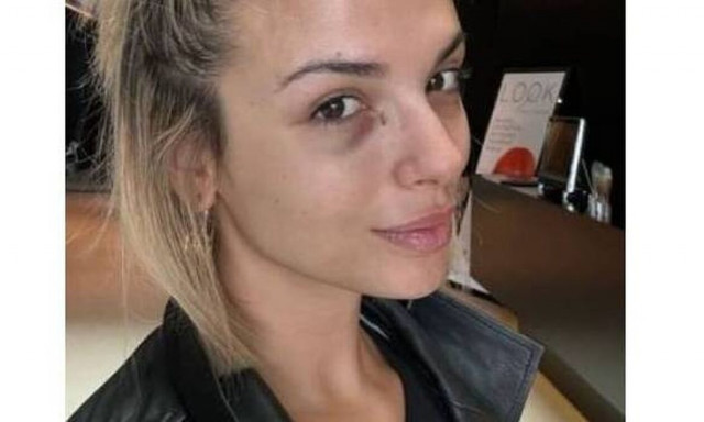 Κατερίνα Λιόλιου: Οι πρώτες δηλώσεις μετά το περιστατικό με το αιχμηρό αντικείμενο