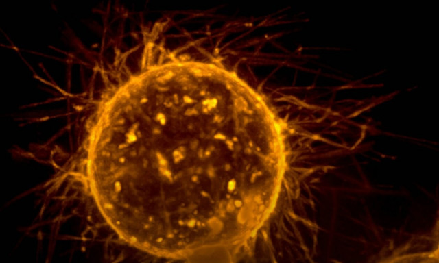 Ελπίδα κατά του καρκίνου: Νέα πρωτοποριακή μέθοδος καταστρέφει το 99% των καρκινικών κυττάρων