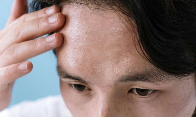 Γιατί είναι πολύ καλό το να ιδρώνεις πολύ;