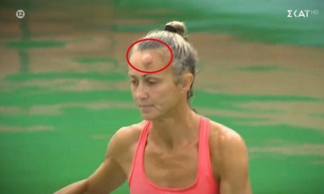 Σοκαριστική σύγκρουση στο Survivor: Αδιανόητο καρούμπαλο στο κεφάλι Μαχήτριας (vid)