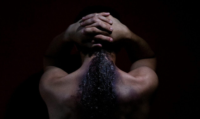 Σοκ από την αποτρόπαιη βία στο Άργος - Απολογείται ο άνδρας που έλουσε τη σύζυγό του με χλωρίνη