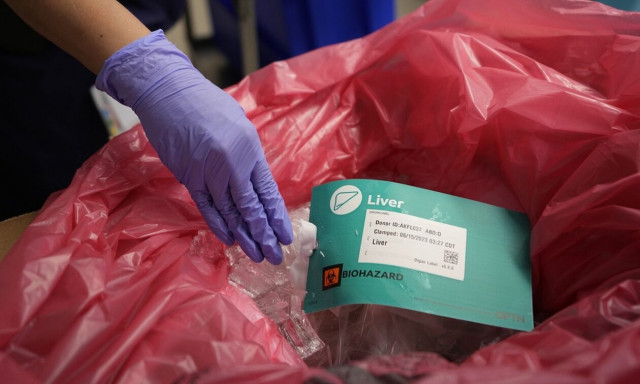 Ελληνικός Οργανισμός Μεταμοσχεύσεων: Νέο ρεκόρ δοτών συμπαγών οργάνων