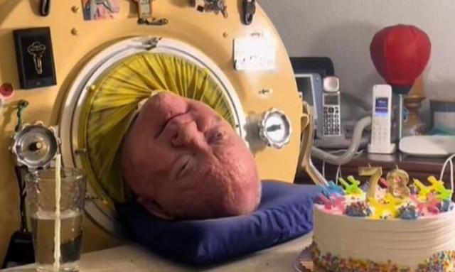 Πέθανε ο άνδρας που έζησε 70 χρόνια σε έναν σιδερένιο πνεύμονα - Η εκπληκτική ζωή του «Polio Paul»