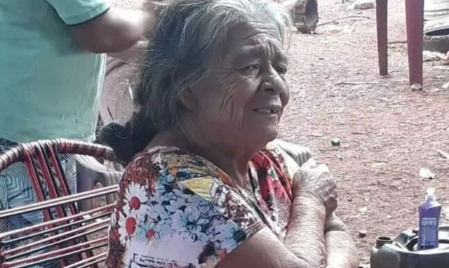 Βραζιλία: Πίστευαν πως είχε καρκίνο και κυοφορούσε... πέτρινο παιδί - Απίστευτες εικόνες