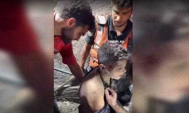 Γάζα: Παιδί ανασύρεται από τα ερείπια - «Έχω μαζέψει λεφτά, θέλω να πάρω ποδήλατο»