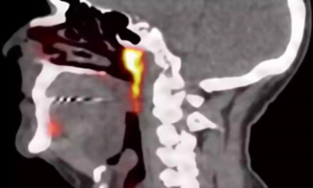 Οι επιστήμονες ανακάλυψαν τυχαία ένα νέο όργανο στο ανθρώπινο σώμα