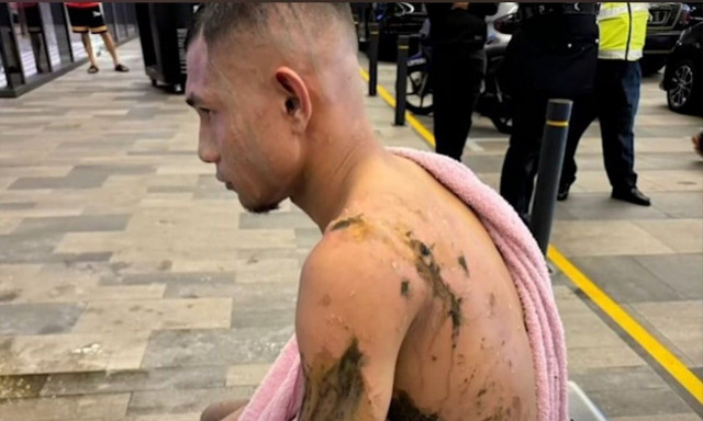 Μαλαισία: Στην εντατική διεθνής ποδοσφαιριστής μετά από επίθεση με καυστικό οξύ