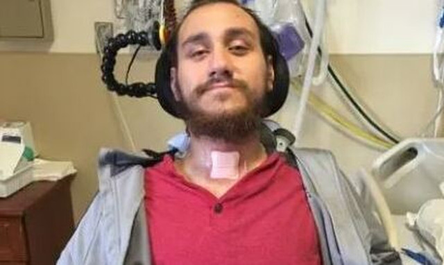 Έλον Μασκ: Eπιπλοκές με το πρώτο τσιπ εγκεφάλου της Neuralink - Πού «σκόνταψε» το εγχείρημα