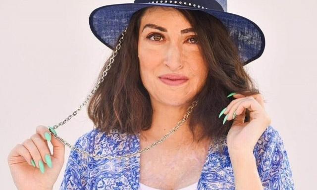 Ιωάννα Παλιοσπύρου: «Δεν θα αποκατασταθώ ποτέ πλήρως - Ό,τι καίγεται, χάνεται για πάντα»