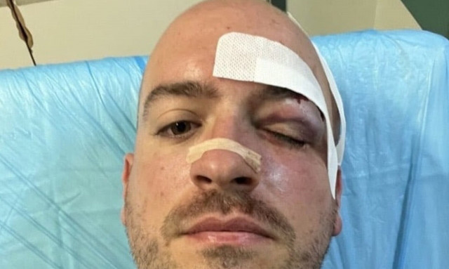 Πάρνηθα: Νεαροί μαχαίρωσαν εθελοντές που καθάριζαν την περιοχή - Φώναζαν «κάναμε Comeback»