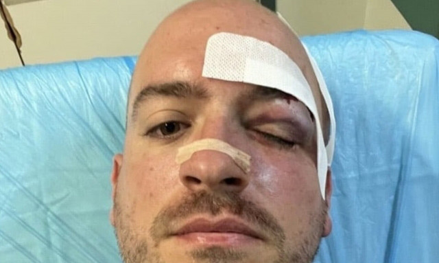 Πάρνηθα: «Έψαχναν αφορμή για καβγά», λένε οι εθελοντές