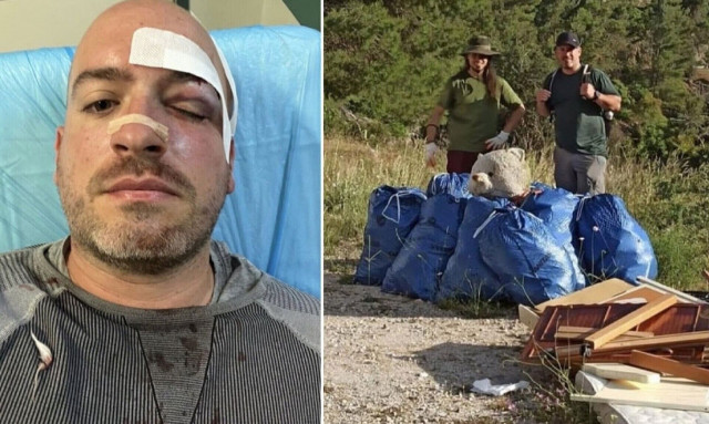 Επίθεση στην Πάρνηθα: Εντοπίστηκε η συμμορία από το Μενίδι που επιτέθηκε σε εθελοντές