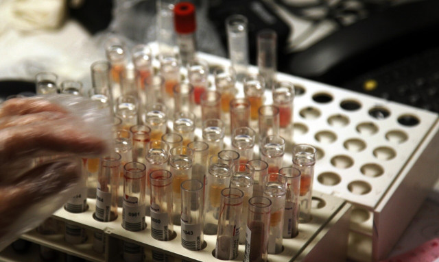 Σπάνιο ξέσπασμα μυκητιάσεων: Επικίνδυνη λοίμωξη μεταδίδεται με την ερωτική πράξη