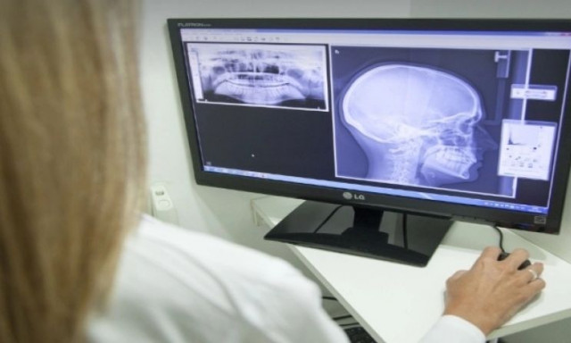 Κρήτη: Άνδρας δέχθηκε σφαίρα στον εγκέφαλο και κατάφερε να επιβιώσει