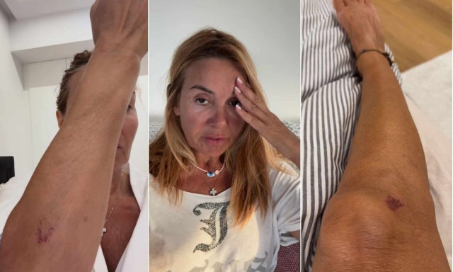 Χριστίνα Παππά: «Με πάτησε με το αυτοκινητό του και με έβριζε χυδαία»