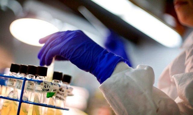 Ελπίδες για τη θεραπεία του Πάρκινσον  - Νέο τεστ προβλέπει έγκαιρα τη νόσο με τη βοήθεια ΑΙ