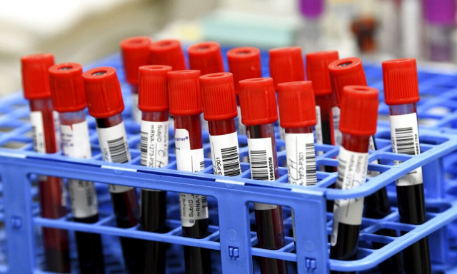 Kατάργηση του clawback ζητούν οι εργαστηριακοί γιατροί - «Οδηγούμαστε σε λουκέτο»