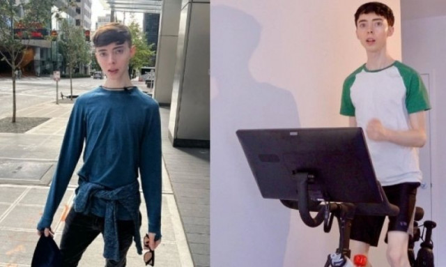 Ο 35χρονος που μοιάζει με έφηβο αποκάλυψε τα μυστικά του κατά της γήρανσης