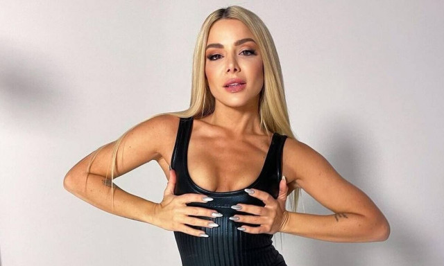 Ζόζεφιν: Αποκάλυψε την πλαστική επέμβαση που έκανε στα 17 της