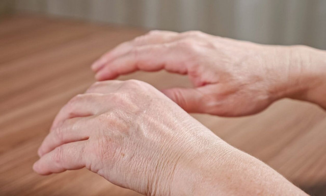 Δύο σημάδια των χεριών που μπορεί να αποκαλύπτουν προβλήματα στην καρδιά