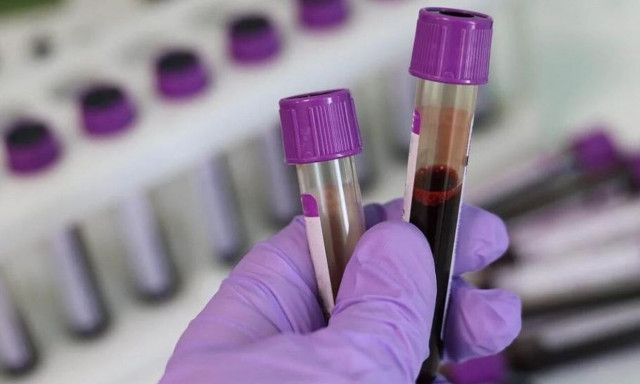 ΟΗΕ: Καθοριστική χρονιά το 2024 ώστε το AIDS να σταματήσει να αποτελεί απειλή για τη δημόσια υγεία