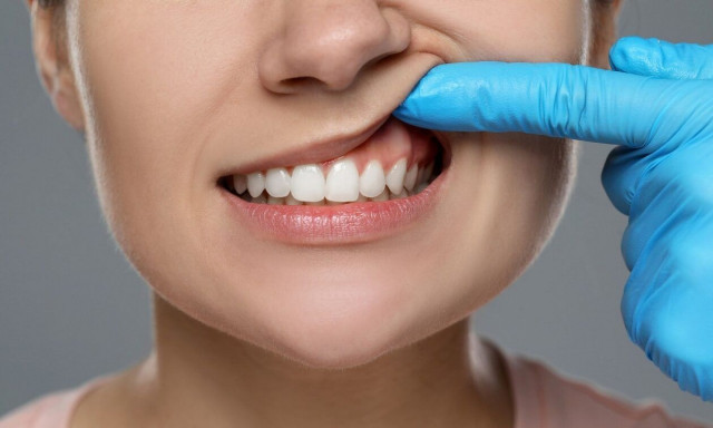 «Όλοι κάνετε ένα συγκεκριμένα λάθος στο πρωινό βούρτισμα» - Οδοντίατρος κάνει την αποκάλυψη