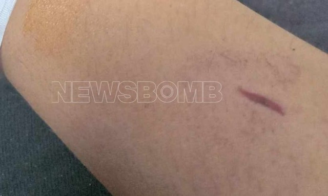 Αρτέμιδα: Ένταλμα σύλληψης για τον πρώην σύντροφο της 27χρονης που τη μαχαίρωσε