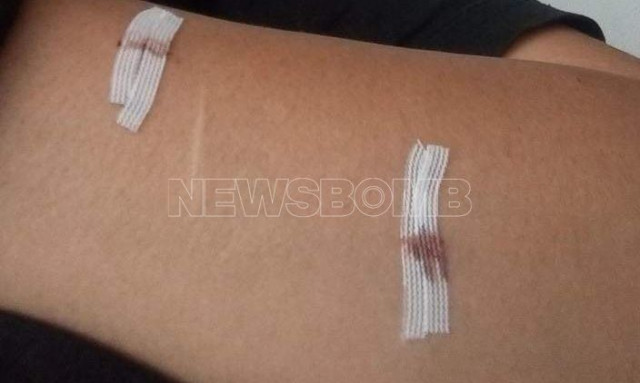 Την ξυλοκόπησε και τη διέσυρε με ροζ βίντεο και τώρα τη μαχαίρωσε - Αναζητείται ο δράστης