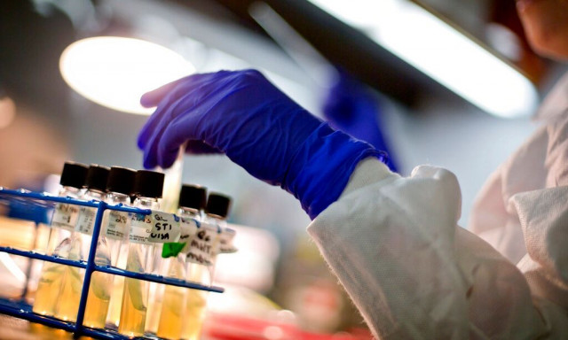 Ιλαρά: 1.891 κρούσματα μόνο τον Ιούνιο στην Ευρώπη - Έξαρση σε 5 χώρες, τι γίνεται στην Ελλάδα