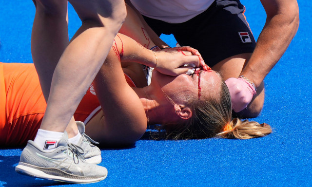 Ολυμπιακοί Αγώνες 2024: Σοκαριστικός τραυματισμός στον ημιτελικό γυναικών του χόκεϊ