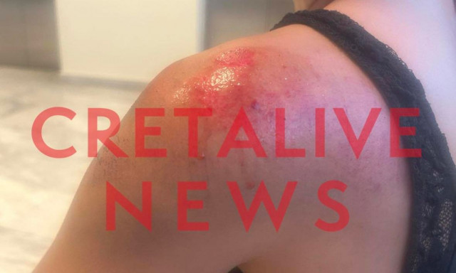 Ηράκλειο: Φωτογράφισε απόκρυφα σημεία της, την χτύπησε με μηχανάκι και την έσυρε για 20 μέτρα