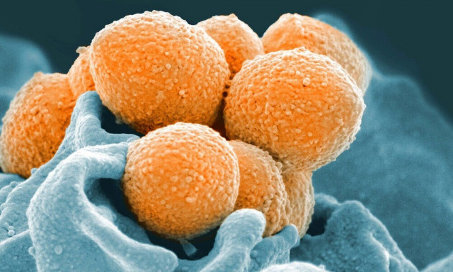 Ηλεία: Δεύτερος θάνατος από διεισδυτικό στρεπτόκοκκο - Κρούσμα νοσηλεύεται σε κρίσιμη κατάσταση