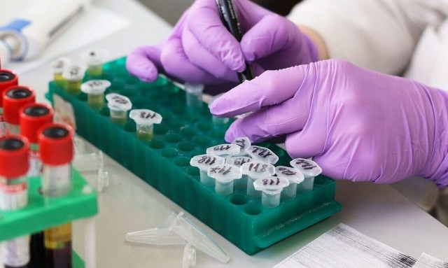 Κορονοϊός: 29 νέοι θάνατοι και 771 εισαγωγές στα νοσοκομεία