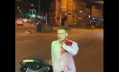 Μπέρμιγχαμ: Μαχαίρωσαν άνδρα στη μέση του δρόμου - Τέσσερις συλλήψεις - Σκληρές εικόνες