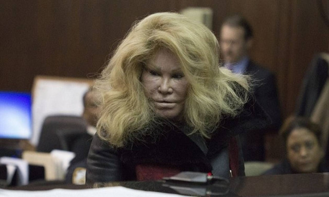 «Γυναίκα γάτα»: Πώς ήταν πριν τις πλαστικές επεμβάσεις - Η φωτογραφία με... το αληθινό της πρόσωπο