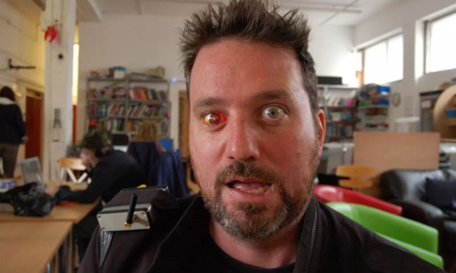 Ο άνθρωπος που αντικατέστησε το χαμένο του μάτι με μια ασύρματη κάμερα εξηγεί γιατί το έκανε