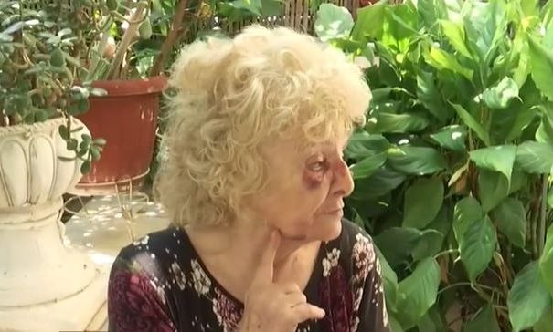 Βύρωνας: Τρόμος για δύο γυναίκες από την εισβολή ληστή - Χτύπησε με κουτουλιά 86χρονη