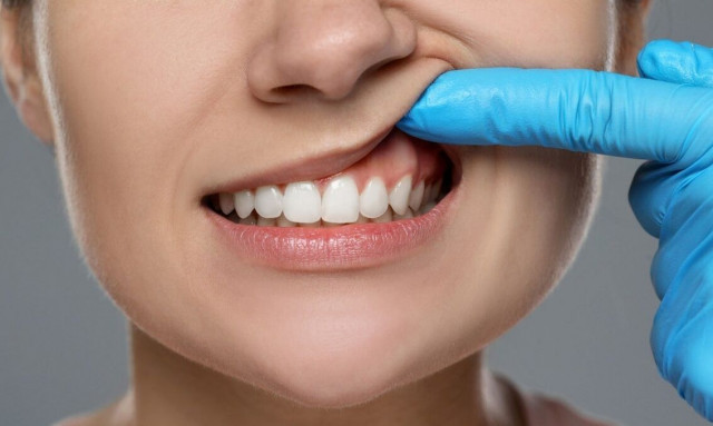 Αυτά τα δύο λάθη κιτρινίζουν τα δόντια - Τι συνιστούν οι ειδικοί