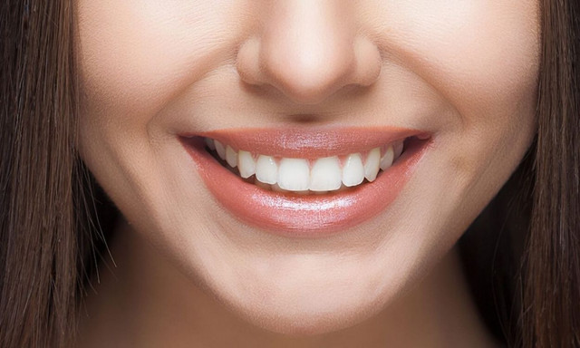 Αρχαία ασθένεια που προκαλεί πτώση των δοντιών εμφανίστηκε ξανά - Τα πρώτα συμπτώματα