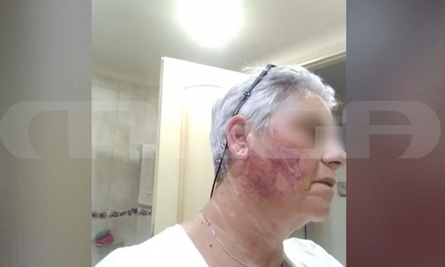 Χαλκίδα: Μαρτύρησε νοσηλεύτρια στα χέρια του συζύγου της - «Έλα να δεις που θα σφάξω τη μάνα σου»