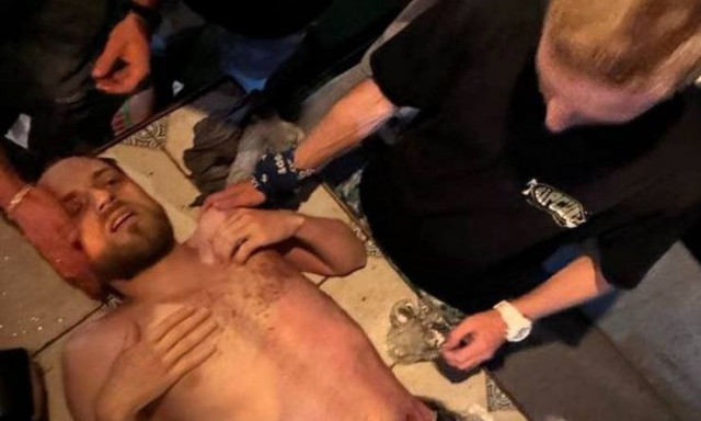 Κεραυνός χτύπησε τουρίστα στη Γεωργία: «Σαν να είχαν πάρει φωτιά τα σωθικά μου»