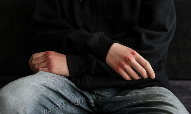 Πύργος Ηλείας: ΚΤΕΛ άφησε στο σχολείο αιμόφυρτο και βαριά τραυματισμένο 6χρονο μαθητή