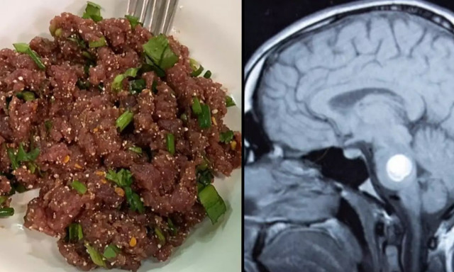 Μην φάτε ποτέ αυτό το φαγητό - Προκαλεί καρκίνο στο συκώτι με μια μπουκιά