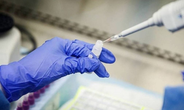 Εφιάλτης από τον ιό Μάρμπουργκ που σήμανε συναγερμό στο Αμβούργο - Θανατηφόρα ασθένεια