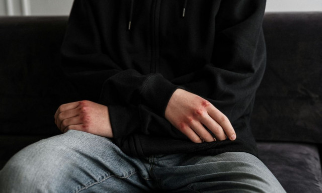 Δεν έχει τέλος η βία ανηλίκων: Δέκα έφηβοι ξυλοκόπησαν 13χρονο στη Χαλκίδα