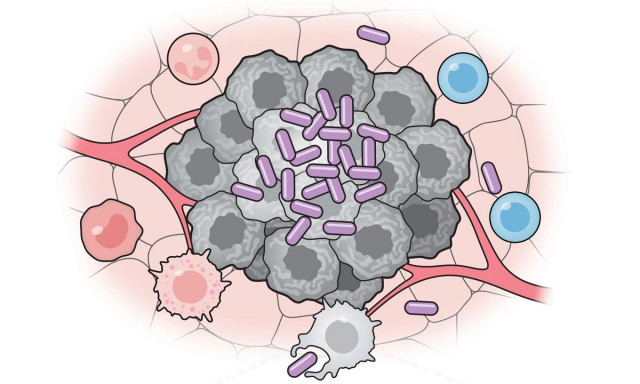 Βακτήρια κατά του καρκίνου: Πειραματικό εμβόλιο καταστρέφει καρκινικά κύτταρα