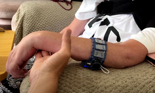 Βραχιόλι «επανασυνδέει» το μυαλό των ασθενών, που έχουν υποστεί εγκεφαλικό, με τα άκρα τους!