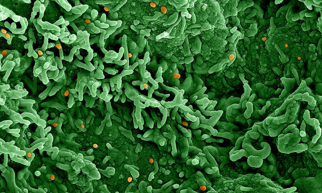 Αυξάνονται τα κρούσματα mpox στην Ευρώπη - Σε ετοιμότητα για διαγνωστικά τεστ